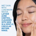 CERAVE ACNE CONTROL CLEANSER -237ML - Image 4