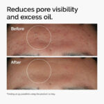 THE ORDINARY NIACINAMIDE 10% + ZINC 1%  - 30ML - Image 6