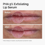 THE ORDINARY PHA 5% EXFOLIATING LIP SERUM - 30ml - Image 6