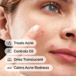 “The Ordinary Sulfur Powder-to-Cream Concentrate bottle on white background” “Powder-to-cream sulfur acne treatment texture close-up” “The Ordinary sulfur acne spot treatment for fast pimple reduction”